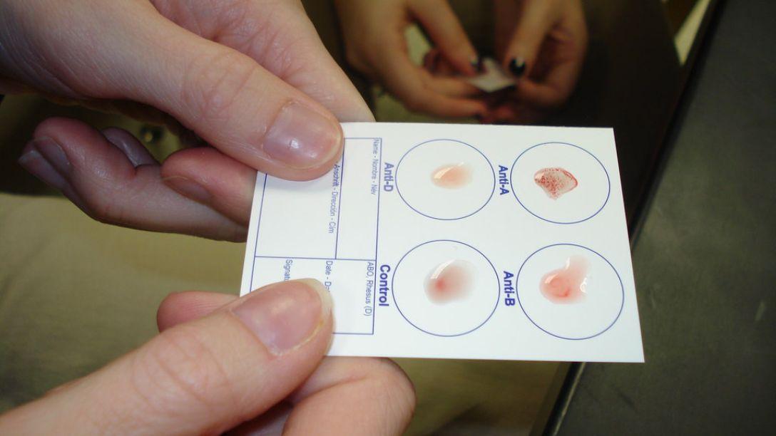 Blood Typing